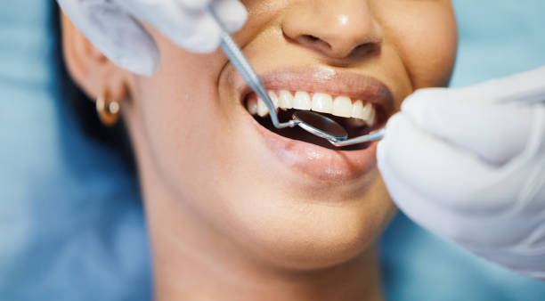 Best Broken or Cracked Tooth Emergency Dentist in Harrisville, UT