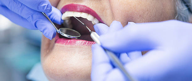 Best Emergency Dental Care for Abscessed Tooth in Harrisville, UT